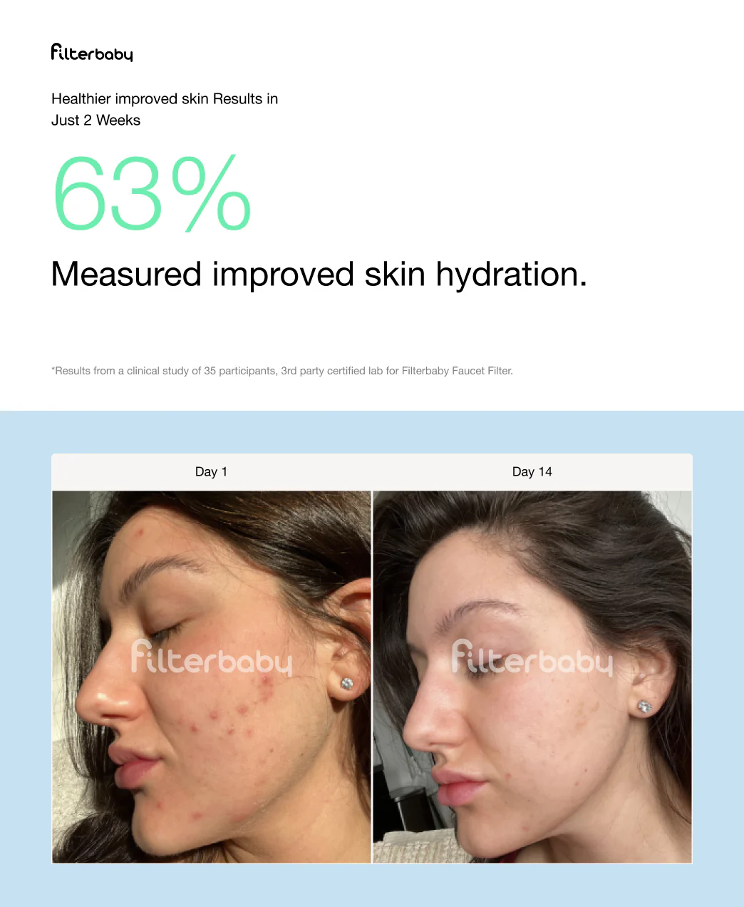 Faucet + Diamond Series Shower Filter Bundle - Image 42