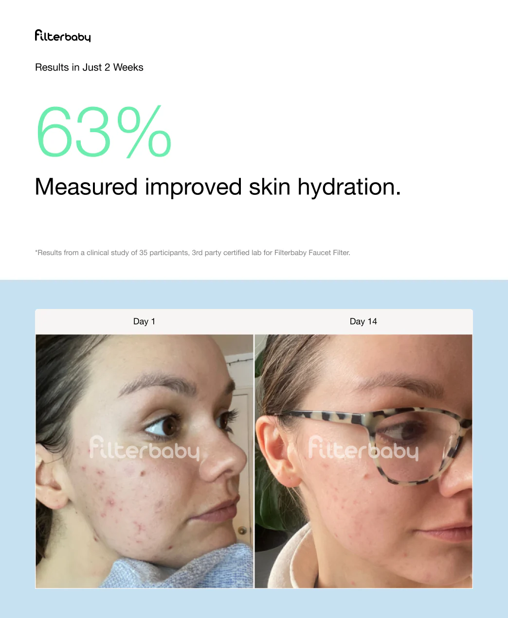 Filterbaby Pro Series Titanium Aluminum Shower Filter (2-Pack) - Image 39