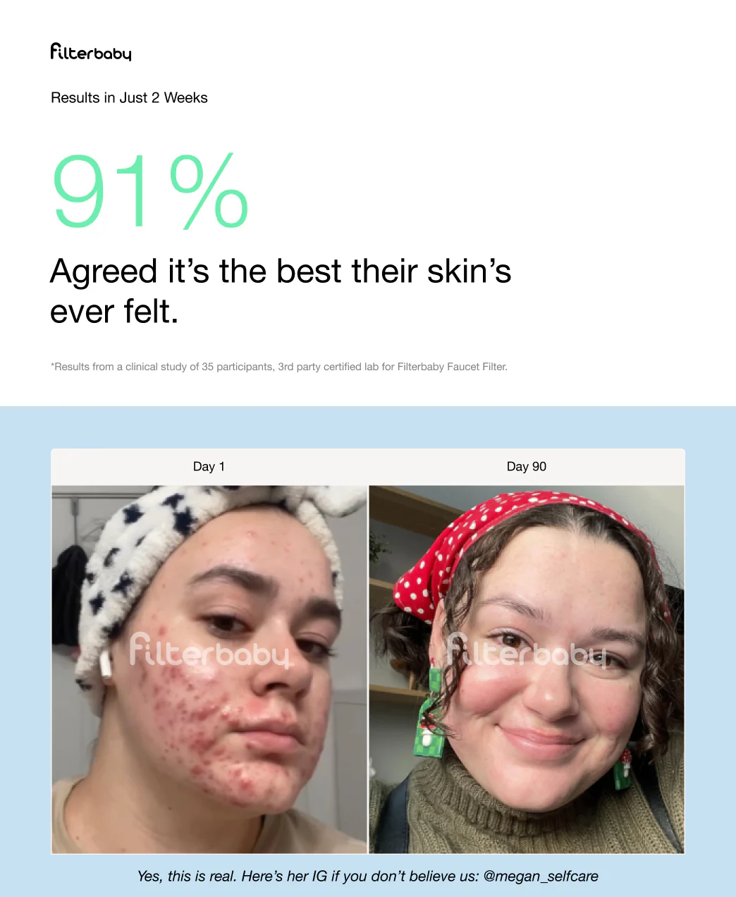 Filterbaby Pro Series Titanium Aluminum Shower Filter (2-Pack) - Image 41