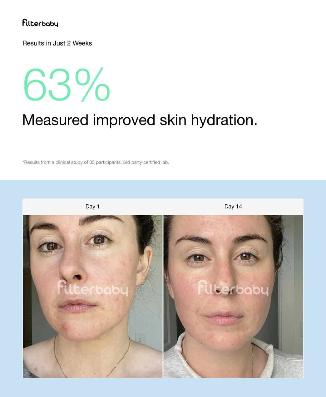 Filterbaby Skincare Faucet Filter 2.0 - Image 15