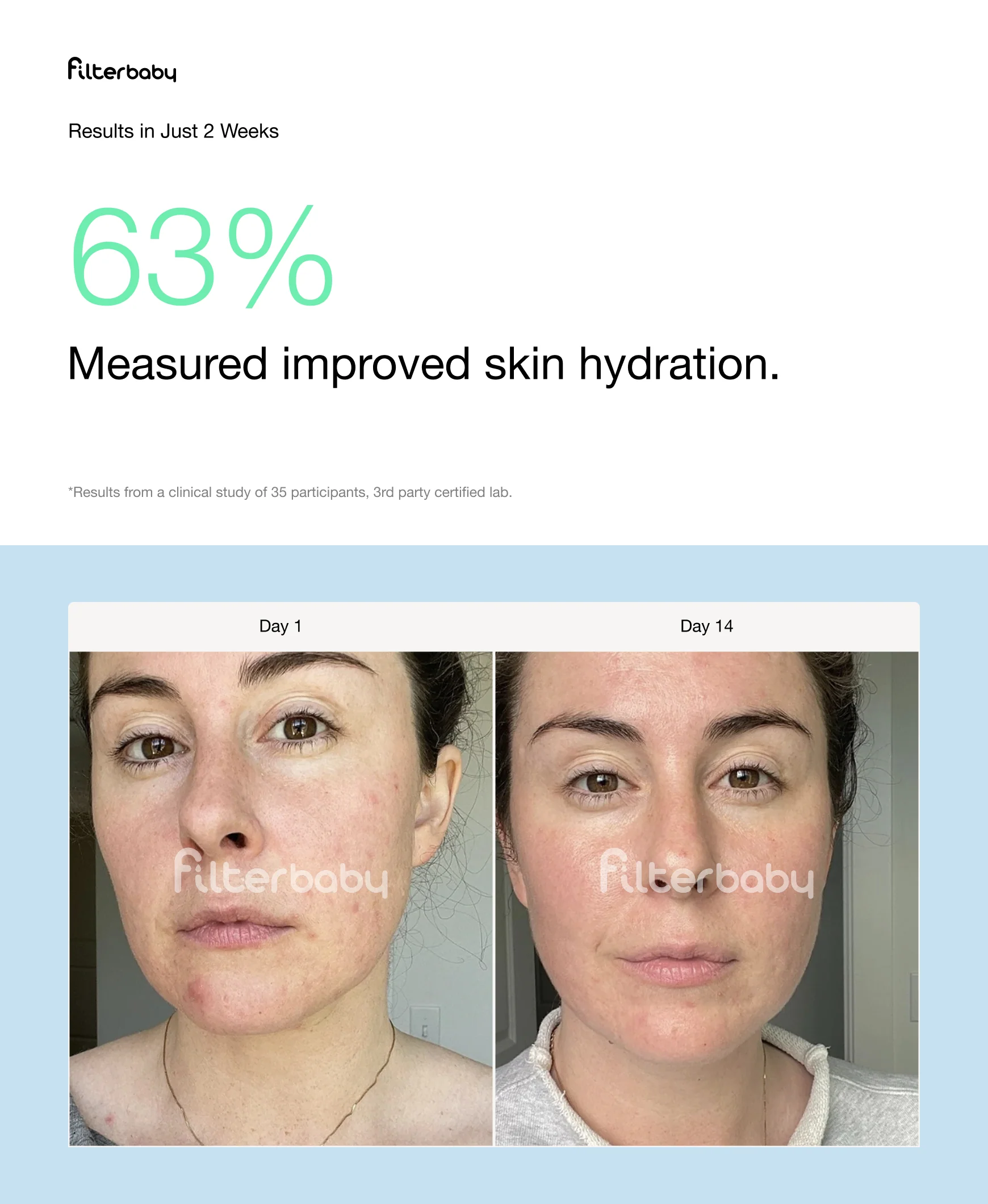 Filterbaby Skincare Filter 2.0 (2 Filter Refills Included) - Image 48