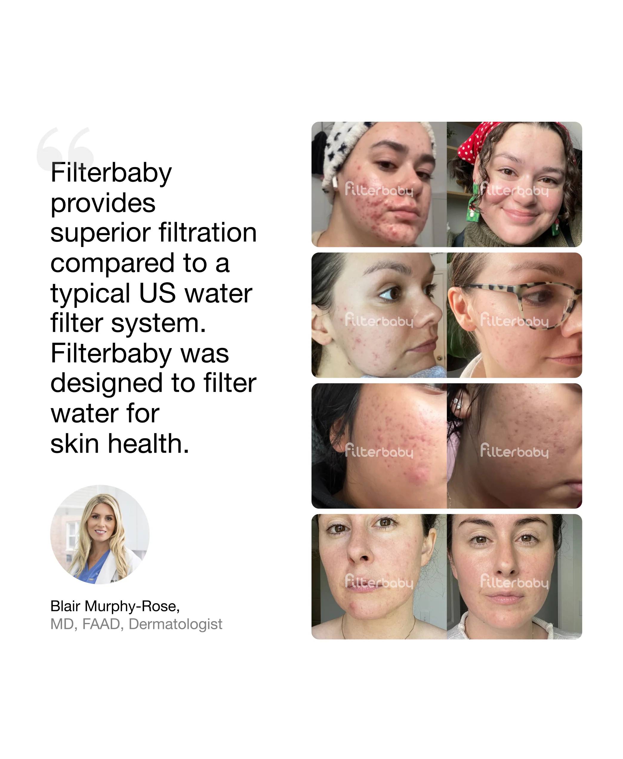 Filterbaby Skincare Filter 1.0 - Image 10